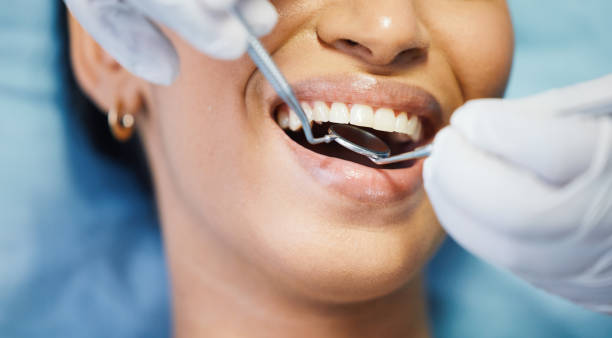 Best Emergency Dentist for Knocked-Out Tooth in Kemp Mill, MD
