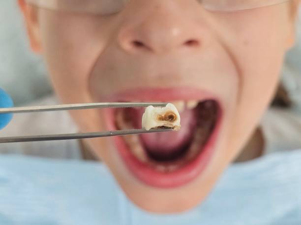 Best 24-Hour Emergency Dentist in Kemp Mill, MD