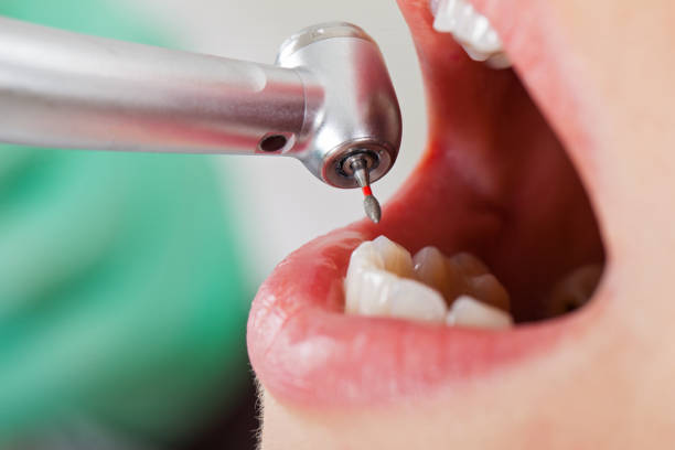 Best Pediatric Emergency Dentist in Kemp Mill, MD